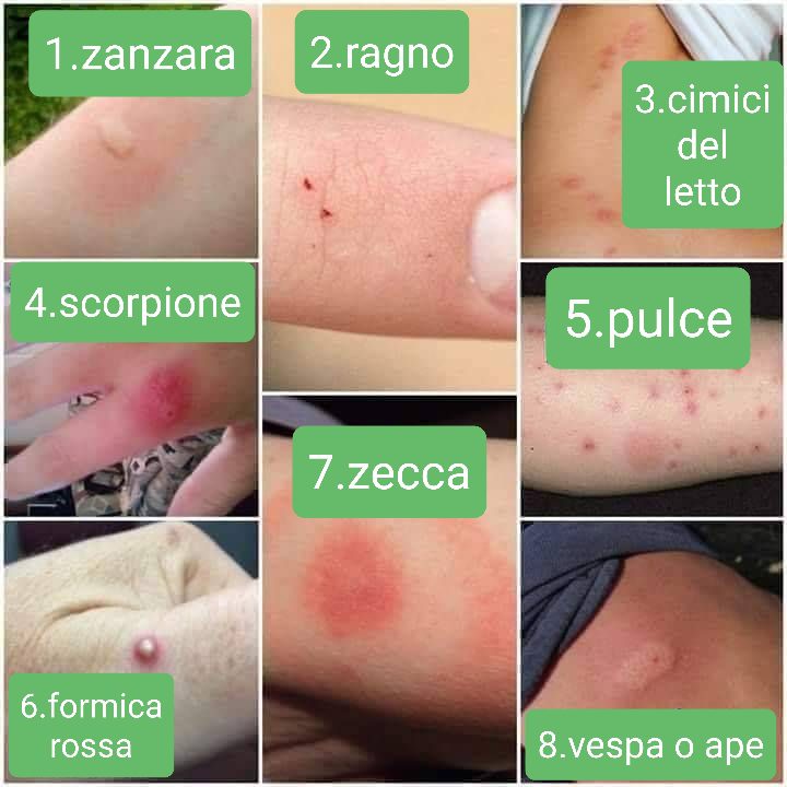 Punture Di Insetti O Acari Come Riconoscerle Ongaro Disinfestazioni
